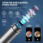 SoulLife Xlife-Series Ear Wax Removal Tool with Camera & Light - Image 2