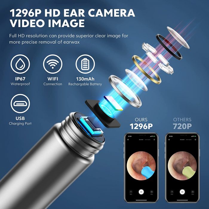 SoulLife Xlife-Series Ear Wax Removal Tool with Camera & Light - Image 2